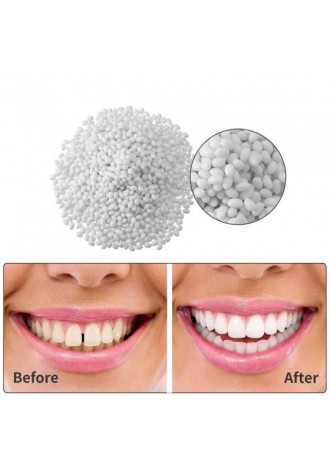 50g Tooth Repair Kit Dental Care Glue for Filling Missing Broken Crowns and Bridges Moldable